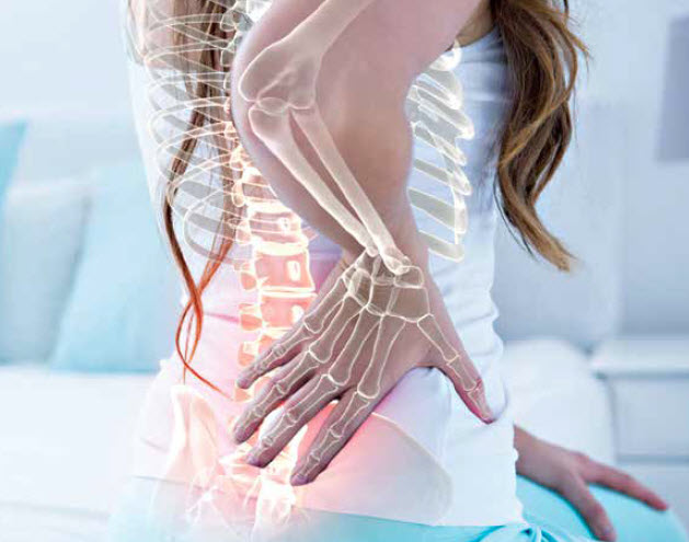 Osteoporosis What I Would Do – The Alternative Approach